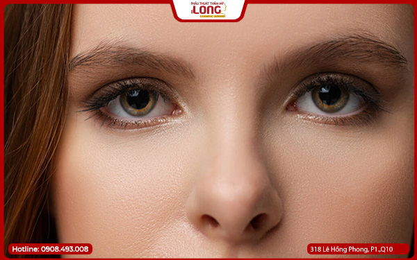 mo-rong-goc-mat-bao-nhieu-tien