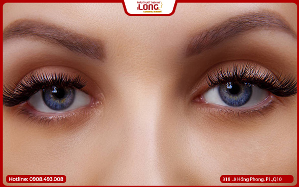 mo-rong-goc-mat-co-dau-khong