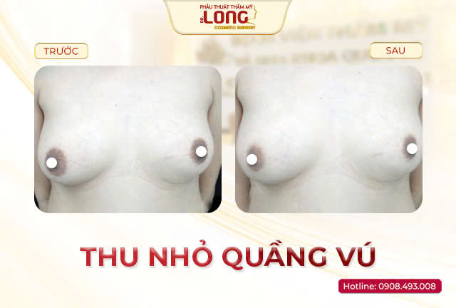 thu-nho-quang-vu