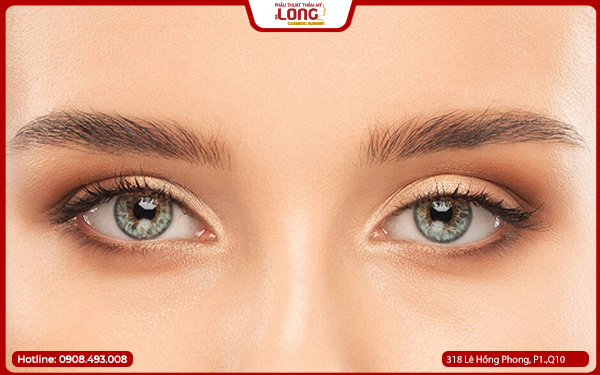 Ai nên và không nên mở rộng góc mắt