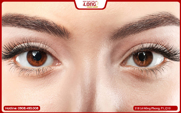 bac-si-lay-bong-mo-mat