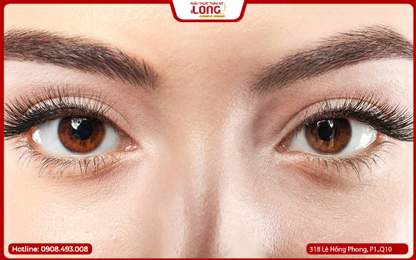 co-nen-mo-rong-goc-mat-khong