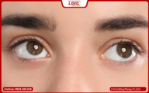 lay-bong-mo-mat-quan-10