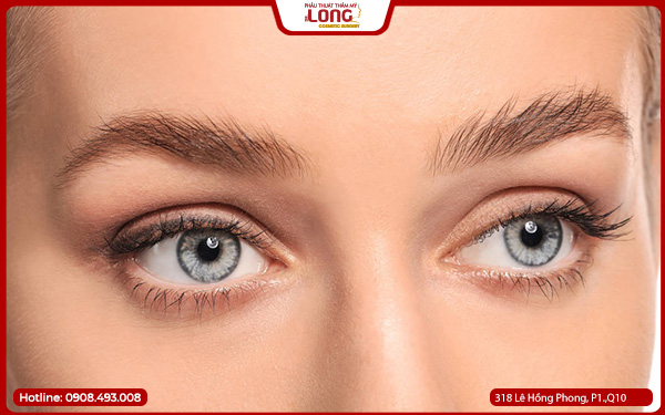 mo-rong-goc-mat-quan-10