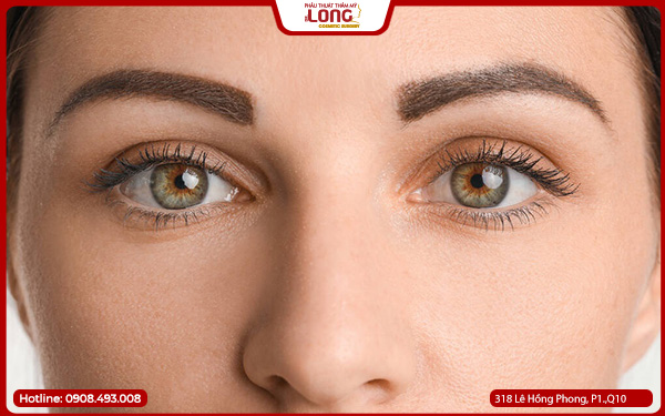 Nâng chân mày bao lâu hồi phục