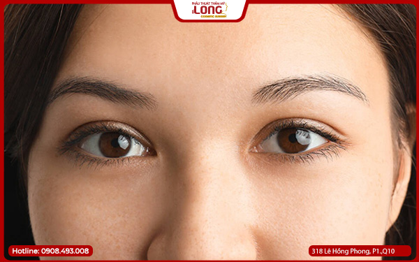 nguyen-nhan-khien-bong-mo-mat