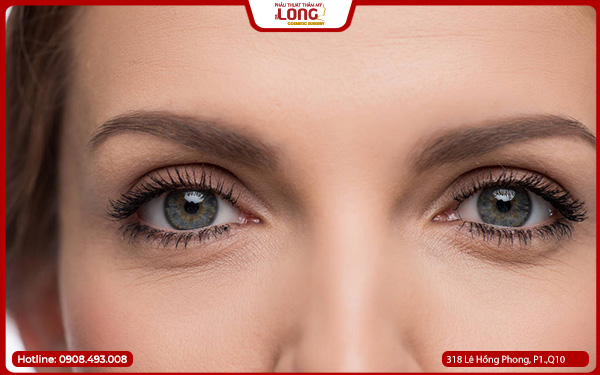 rui-ro-khi-mo-rong-goc-mat