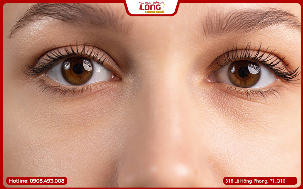 thoi-gian-hoi-phuc-sau-lay-bong-mo-mat