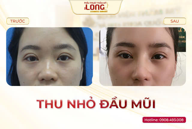 thu-nho-dau-mui-chi-lan