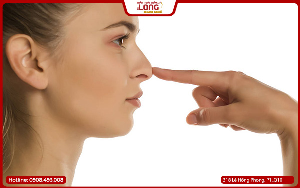 Cắt cánh mũi có an toàn không