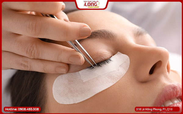 Cắt mí có ảnh hưởng gì không