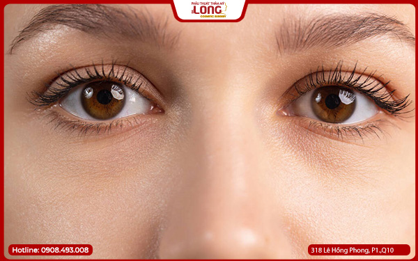 chuan-bi-truoc-khi-mo-rong-goc-mat