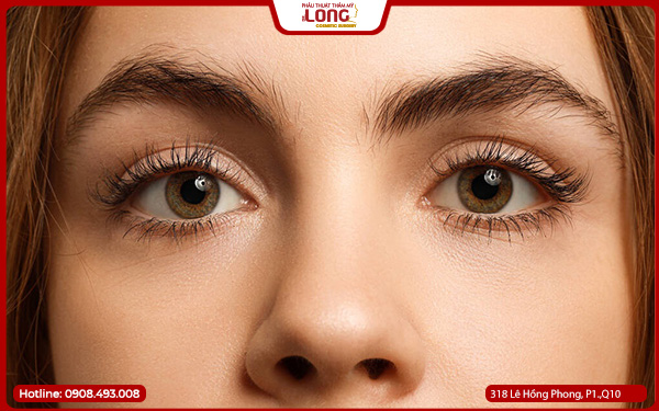 Lấy bọng mỡ mắt có ảnh hưởng gì không