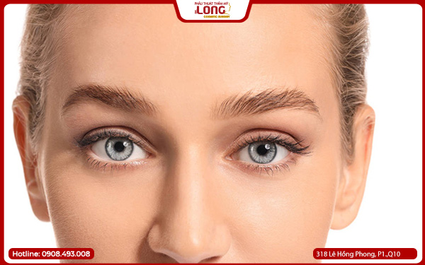 Lưu ý khi lấy bọng mỡ mắt