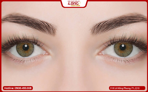 Mở rộng góc mắt có ảnh hưởng thị lực không