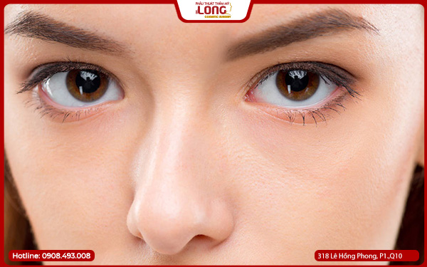 Nâng chân mày có ảnh hưởng thị lực không