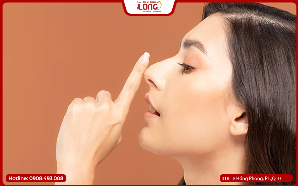 5. Nâng mũi cấu trúc có phù hợp với mọi cơ địa không? Đa số cơ địa phù hợp, nhưng người có tiền sử sẹo lồi cần trao đổi kỹ với bác sĩ để được tư vấn phương án hạn chế sẹo.