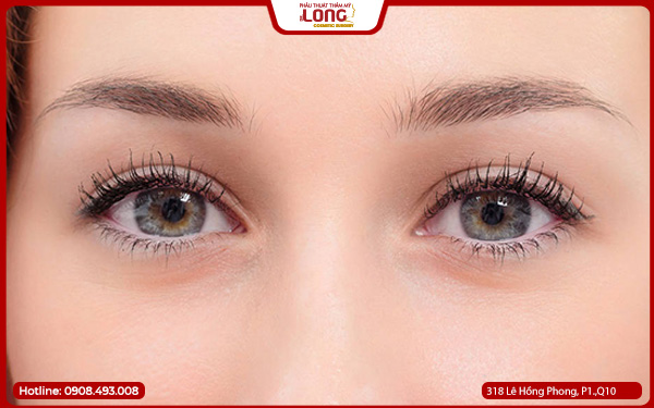 qua-trinh-mo-rong-goc-mat