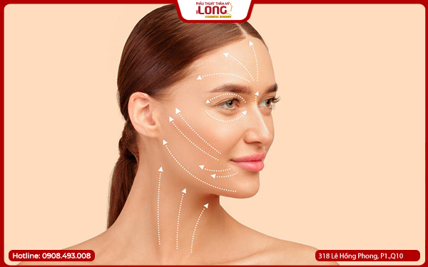 Ai nên và không nên căng da mặt phẫu thuật