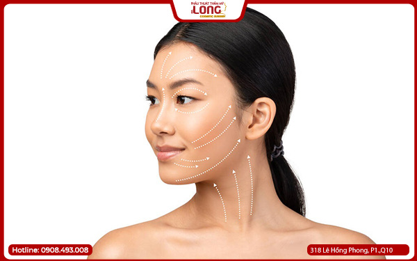 Căng da mặt bao nhiêu tiền