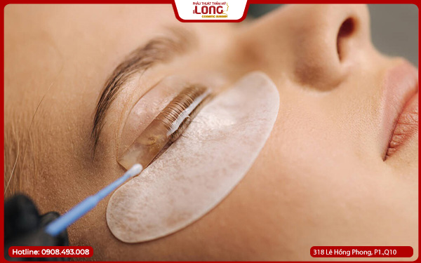 Điều cần tránh sau khi cắt mí