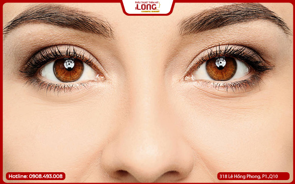 khi-nao-nen-lay-bong-mo-mat