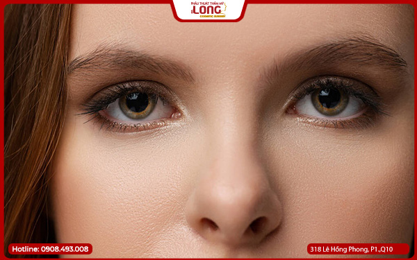 Trải nghiệm sau khi lấy bọng mỡ mắt