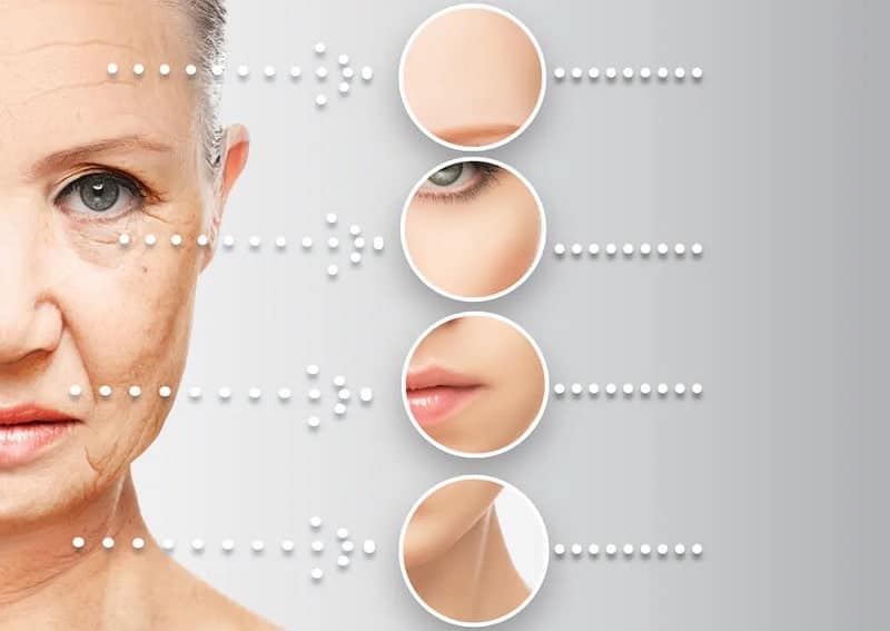 căng da mặt midface là gì
